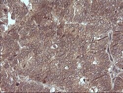 MAP2K3 Monoclonal Antibody (OTI1H6), TrueMAB , OriGene 100 &mu;L; Unconjugated:Antibodies,