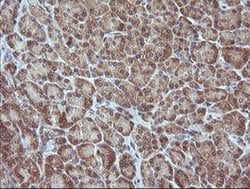 MAP2K3 Monoclonal Antibody (OTI1H6), TrueMAB , OriGene 100 &mu;L; Unconjugated:Antibodies,