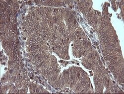 MAP2K3 Monoclonal Antibody (OTI1H6), TrueMAB , OriGene 100 &mu;L; Unconjugated:Antibodies,