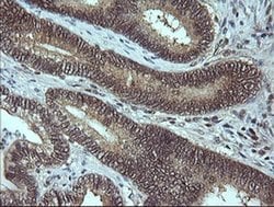 MAP2K3 Monoclonal Antibody (OTI1H6), TrueMAB , OriGene:Antibodies:Primary