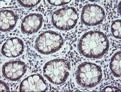MAP2K3 Monoclonal Antibody (OTI1B5), TrueMAB , OriGene:Antibodies:Primary