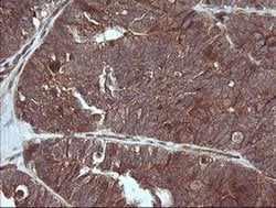 MAP2K3 Monoclonal Antibody (OTI2A7), TrueMAB , OriGene 100 &mu;L; Unconjugated:Antibodies,