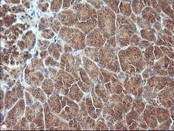 MAP2K3 Monoclonal Antibody (OTI2A7), TrueMAB , OriGene 100 &mu;L; Unconjugated:Antibodies,