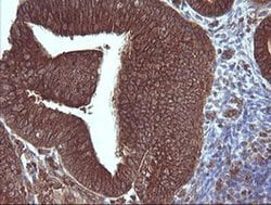 MAP2K3 Monoclonal Antibody (OTI2A7), TrueMAB , OriGene 100 &mu;L; Unconjugated:Antibodies,