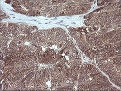 MAP2K3 Monoclonal Antibody (OTI6F8), TrueMAB , OriGene 100 &mu;L; Unconjugated:Antibodies,