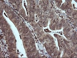 MAP2K3 Monoclonal Antibody (OTI6F8), TrueMAB , OriGene:Antibodies:Primary