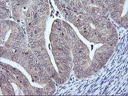 MAP2K3 Mouse anti-Human, Clone: OTI6C6, lyophilized, TrueMAB 100 &mu;g | Buy Online | Origene Technologies | Fisher Scientific