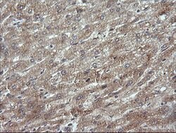 MAP2K3 Mouse anti-Human, Clone: OTI6C6, lyophilized, TrueMAB 100 &mu;g | Buy Online | Origene Technologies | Fisher Scientific