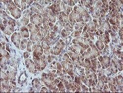 MAP2K3 Monoclonal Antibody (OTI6B12), TrueMAB , OriGene 100 &mu;L; Unconjugated:Antibodies,