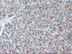 MAP2K3 Monoclonal Antibody (OTI4G4), TrueMAB , OriGene 100 &mu;L; Unconjugated:Antibodies,