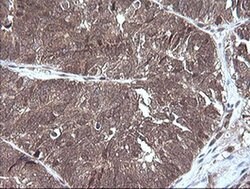 MAP2K3 Monoclonal Antibody (OTI6B11), TrueMAB , OriGene 100 &mu;L; Unconjugated:Antibodies,