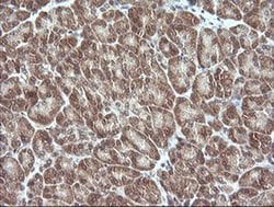 MAP2K3 Monoclonal Antibody (OTI6B11), TrueMAB , OriGene 100 &mu;L; Unconjugated:Antibodies,