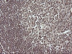 MAP2K3 Monoclonal Antibody (OTI6B11), TrueMAB , OriGene 100 &mu;L; Unconjugated:Antibodies,