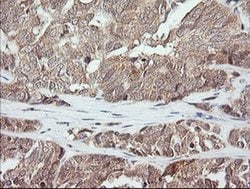 MAP2K3 Monoclonal Antibody (OTI4B3), TrueMAB , OriGene 100 &mu;L; Unconjugated:Antibodies,