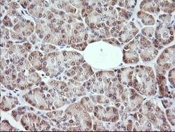 MAP2K3 Monoclonal Antibody (OTI4B3), TrueMAB , OriGene 100 &mu;L; Unconjugated:Antibodies,
