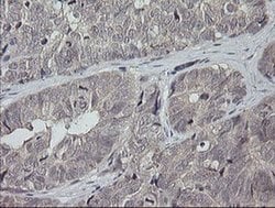 MAP2K3 Monoclonal Antibody (OTI5F9), TrueMAB , OriGene 100 &mu;L; Unconjugated:Antibodies,