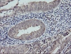 MAP2K3 Monoclonal Antibody (OTI5F9), TrueMAB , OriGene 100 &mu;L; Unconjugated:Antibodies,