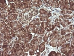 MAP2K3 Monoclonal Antibody (OTI5B2), TrueMAB , OriGene 100 &mu;L; Unconjugated:Antibodies,