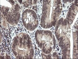MAP2K3 Monoclonal Antibody (OTI5B2), TrueMAB , OriGene 100 &mu;L; Unconjugated:Antibodies,