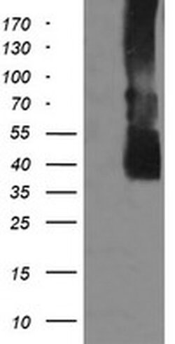 MAP2K3 Monoclonal Antibody (OTI1H6), TrueMAB , OriGene:Antibodies:Primary
