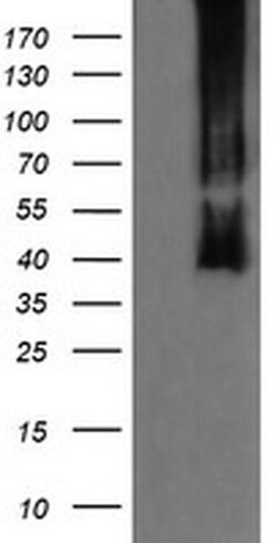 MAP2K3 Monoclonal Antibody (OTI3C8), TrueMAB , OriGene 100 &mu;L; Unconjugated:Antibodies,