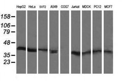 MAP2K3 Monoclonal Antibody (OTI3C8), TrueMAB , OriGene 100 &mu;L; Unconjugated:Antibodies,