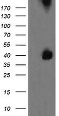 MAP2K3 Monoclonal Antibody (OTI2D7), TrueMAB , OriGene 100 &mu;L; Unconjugated:Antibodies,