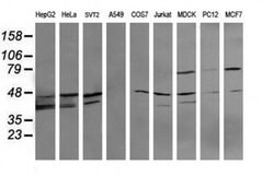 MAP2K3 Monoclonal Antibody (OTI2D7), TrueMAB , OriGene 100 &mu;L; Unconjugated:Antibodies,