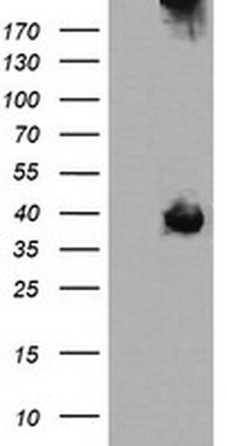 MAP2K3 Monoclonal Antibody (OTI1B5), TrueMAB , OriGene:Antibodies:Primary