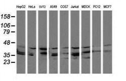 MAP2K3 Monoclonal Antibody (OTI1B5), TrueMAB , OriGene 100 &mu;L; Unconjugated:Antibodies,