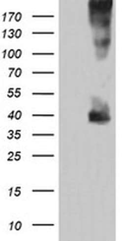 MAP2K3 Monoclonal Antibody (OTI2A7), TrueMAB , OriGene:Antibodies:Primary