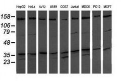 MAP2K3 Monoclonal Antibody (OTI2A7), TrueMAB , OriGene 100 &mu;L; Unconjugated:Antibodies,