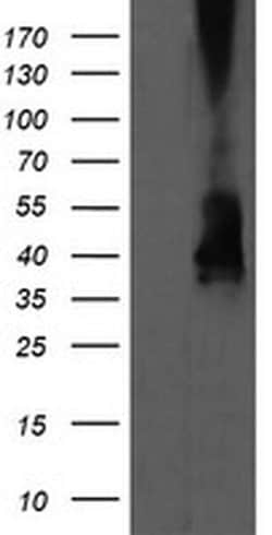 MAP2K3 Monoclonal Antibody (OTI1D2), TrueMAB , OriGene 30 &mu;L; Unconjugated:Antibodies,