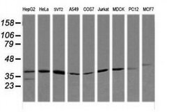 MAP2K3 Monoclonal Antibody (OTI1D2), TrueMAB , OriGene 30 &mu;L; Unconjugated:Antibodies,