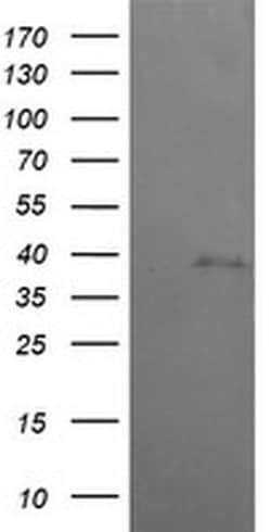 MAP2K3 Monoclonal Antibody (OTI6F8), TrueMAB , OriGene:Antibodies:Primary