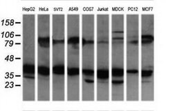 MAP2K3 Monoclonal Antibody (OTI6F8), TrueMAB , OriGene 100 &mu;L; Unconjugated:Antibodies,