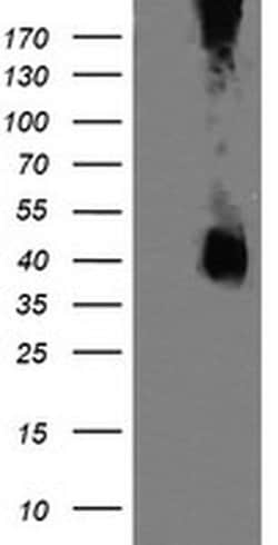 MAP2K3 Monoclonal Antibody (OTI6B12), TrueMAB , OriGene 100 &mu;L; Unconjugated:Antibodies,