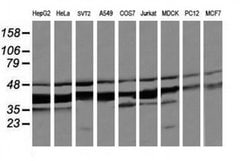 MAP2K3 Monoclonal Antibody (OTI6B12), TrueMAB , OriGene 100 &mu;L; Unconjugated:Antibodies,