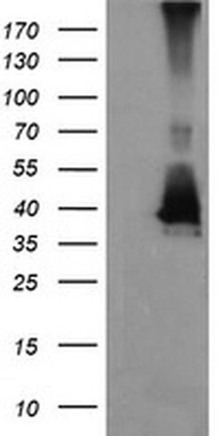 MAP2K3 Monoclonal Antibody (OTI4G4), TrueMAB , OriGene 100 &mu;L; Unconjugated:Antibodies,