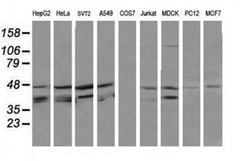 MAP2K3 Monoclonal Antibody (OTI4G4), TrueMAB , OriGene 100 &mu;L; Unconjugated:Antibodies,