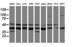 MAP2K3 Monoclonal Antibody (OTI6B11), TrueMAB , OriGene 100 &mu;L; Unconjugated:Antibodies,