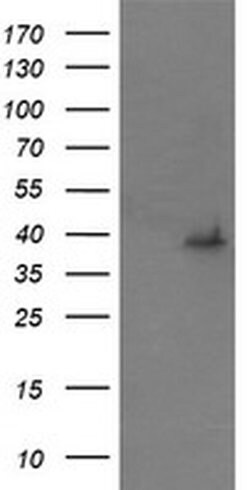MAP2K3 Monoclonal Antibody (OTI4B3), TrueMAB , OriGene 100 &mu;L; Unconjugated:Antibodies,