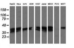 MAP2K3 Monoclonal Antibody (OTI4B3), TrueMAB , OriGene:Antibodies:Primary