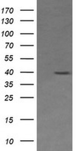 MAP2K3 Monoclonal Antibody (OTI5E2), TrueMAB , OriGene 100 &mu;L; Unconjugated:Antibodies,