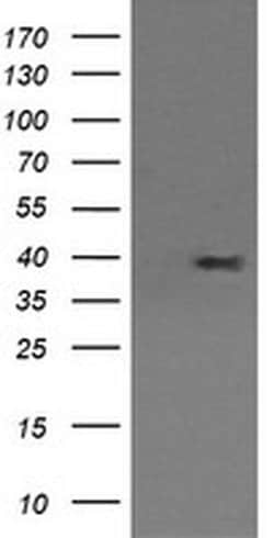 MAP2K3 Monoclonal Antibody (OTI5F9), TrueMAB , OriGene 100 &mu;L; Unconjugated:Antibodies,