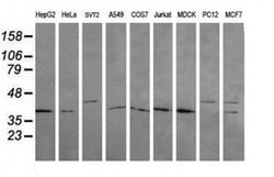 MAP2K3 Monoclonal Antibody (OTI5F9), TrueMAB , OriGene 100 &mu;L; Unconjugated:Antibodies,