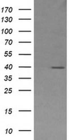 MAP2K3 Monoclonal Antibody (OTI1H3), TrueMAB , OriGene 100 &mu;L; Unconjugated:Antibodies,