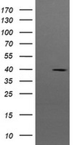 MAP2K3 Monoclonal Antibody (OTI5C4), TrueMAB , OriGene 100 &mu;L; Unconjugated:Antibodies,