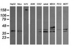 MAP2K3 Monoclonal Antibody (OTI5C4), TrueMAB , OriGene 100 &mu;L; Unconjugated:Antibodies,