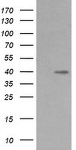 MAP2K3 Monoclonal Antibody (OTI5B2), TrueMAB , OriGene 100 &mu;L; Unconjugated:Antibodies,